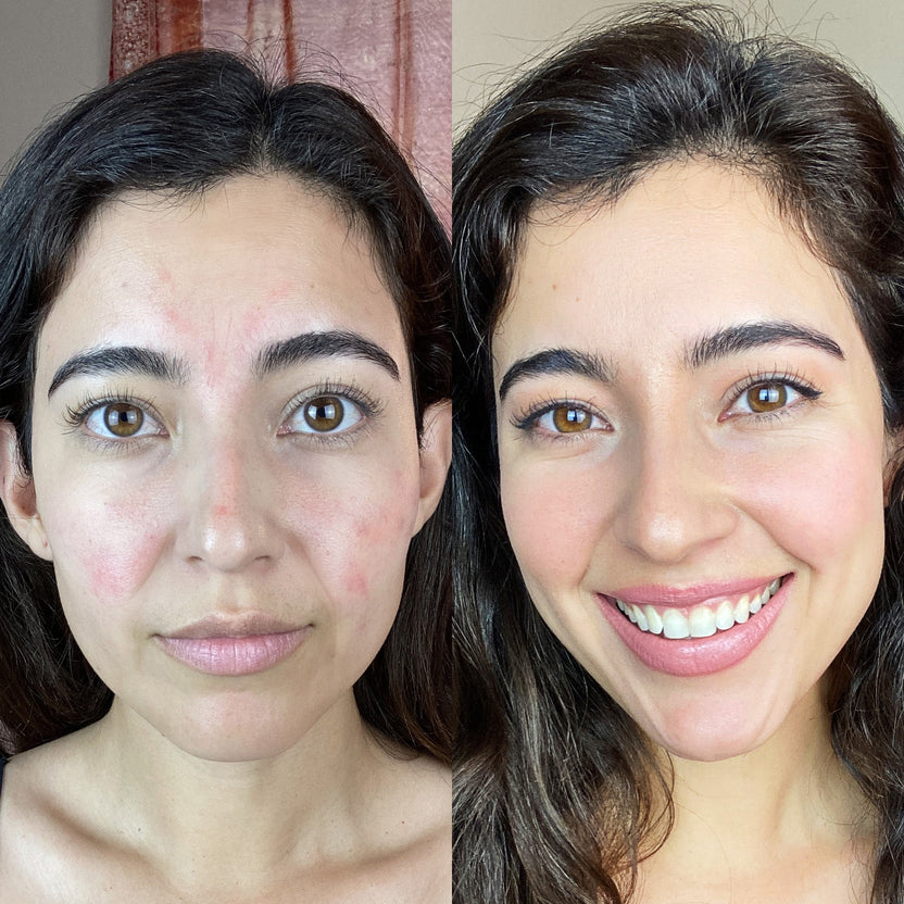 Revive Wand™ – Red Light Therapy & EMS for Wrinkles & Puffiness