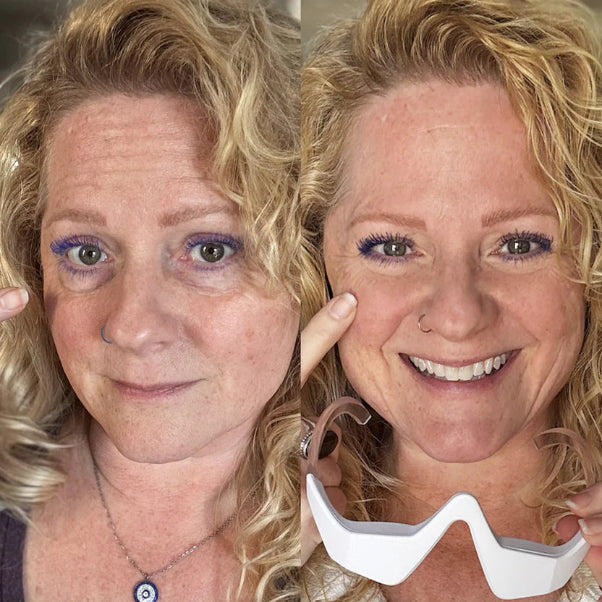 Before and after comparison of a woman with blonde hair and blue eyes, wearing a white mask.