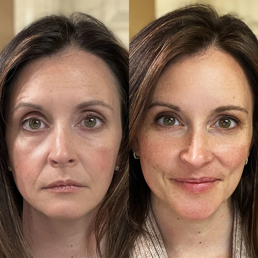 Revive Wand™ – Red Light Therapy & EMS for Wrinkles & Puffiness