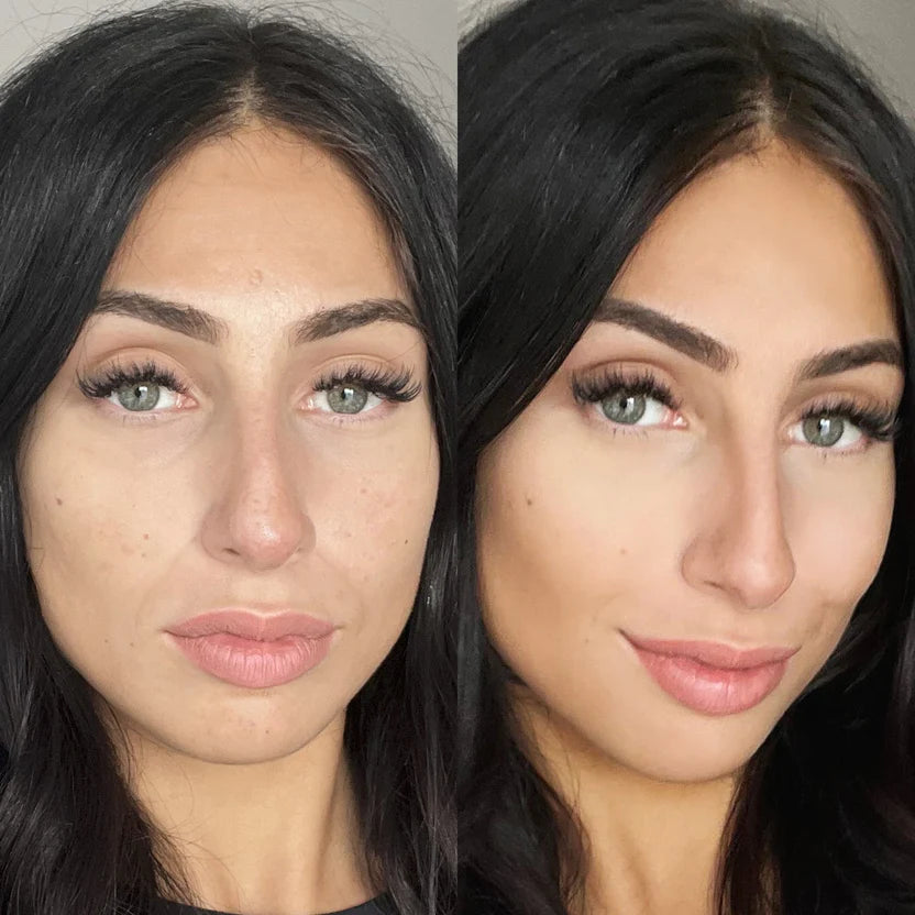 Revive Mask™ – Red Light Therapy & EMS for Dark Circles & Puffiness